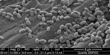 Desulfuromonas acetexigens on a metal electrod surface. Credits: KAUTS.