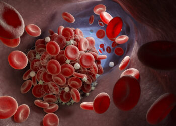 Depiction of a blood clot forming inside a blood vessel. 3D illustration